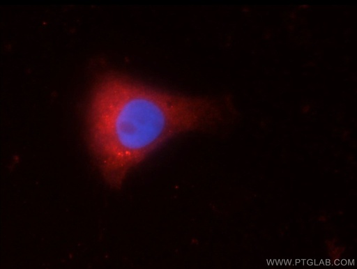 [22637-1-AP-20UL] C9orf72 Polyclonal antibody