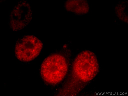 [22638-1-AP-20UL] CCAR2 Polyclonal antibody
