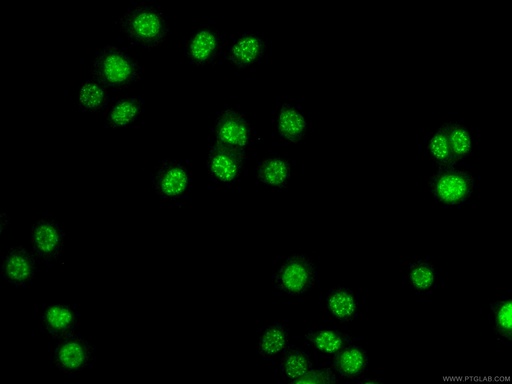 [22641-1-AP-20UL] ATOX1 Polyclonal antibody
