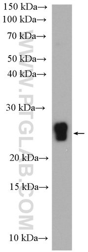 [22648-1-AP-150UL] CSN1S1 Polyclonal antibody