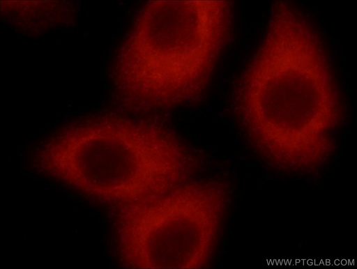 [22673-1-AP-150UL] STARS/ABRA Polyclonal antibody