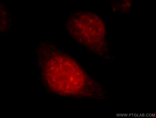 [22675-1-AP-20UL] SART1 Polyclonal antibody