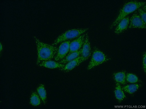 [22676-1-AP-20UL] PPP4R2 Polyclonal antibody