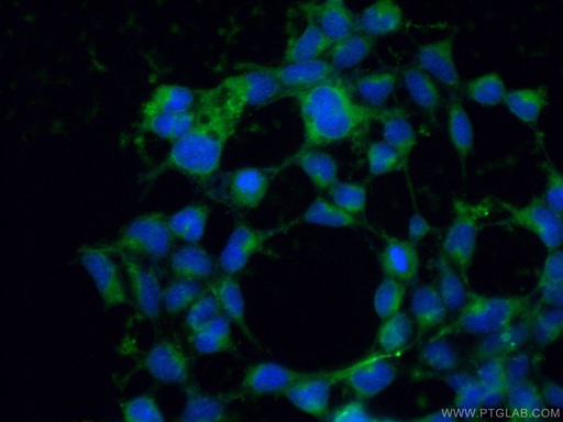 [22683-1-AP-150UL] RBP1 Polyclonal antibody