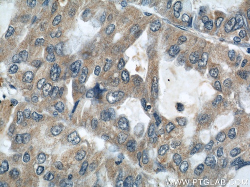 [22696-1-AP-20UL] AARS2 Polyclonal antibody