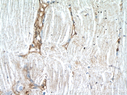 [22697-1-AP-150UL] DOK7 Polyclonal antibody
