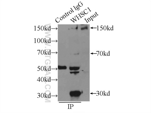 [22722-1-AP-20UL] WHSC1 Polyclonal antibody