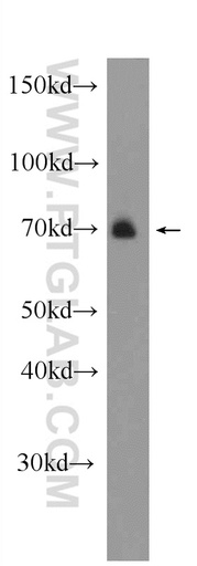 [22723-1-AP-20UL] ARK5 Polyclonal antibody