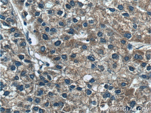 [22762-1-AP-150UL] SARDH Polyclonal antibody