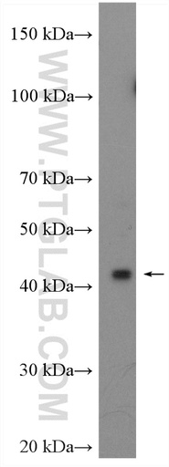 [22784-1-AP-150UL] TWISTNB Polyclonal antibody