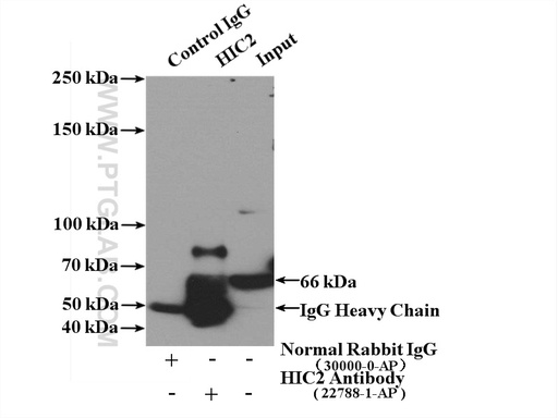 [22788-1-AP-150UL] HIC2 Polyclonal antibody