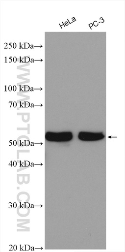 [22792-1-AP-150UL] SPAST Polyclonal antibody