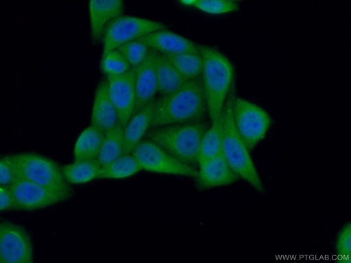 [22802-1-AP-20UL] CCS Polyclonal antibody