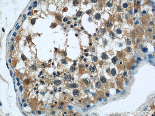 [22838-1-AP-150UL] C7orf30 Polyclonal antibody