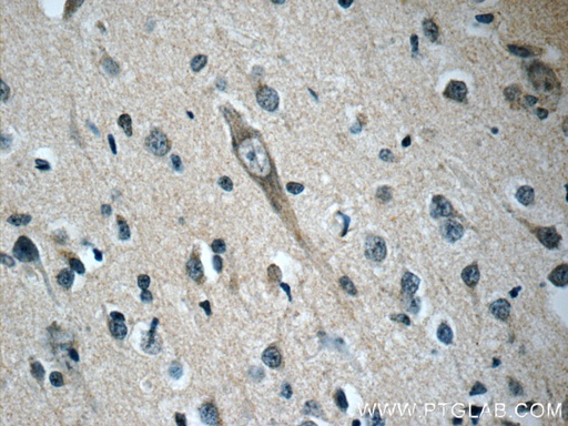 [22851-1-AP-20UL] OFD1 Polyclonal antibody