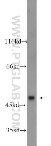 [22858-1-AP-150UL] BMP10 Polyclonal antibody