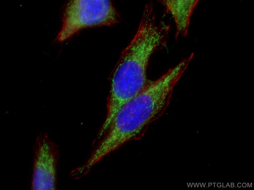 [22862-1-AP-150UL] ACSM2A Polyclonal antibody