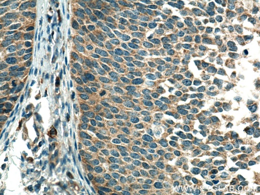 [22870-1-AP-150UL] CSAD Polyclonal antibody