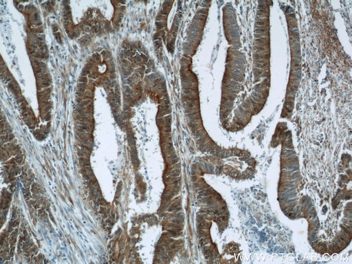 [22879-1-AP-150UL] B3GNT7 Polyclonal antibody