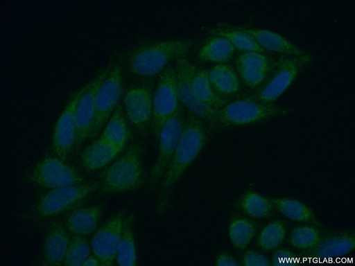 [22882-1-AP-150UL] MEX3C Polyclonal antibody
