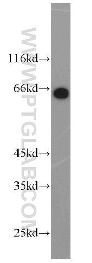 [22883-1-AP-150UL] HSF4 Polyclonal antibody