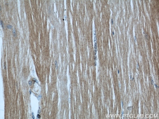 [22900-1-AP-20UL] MYBPC1 Polyclonal antibody