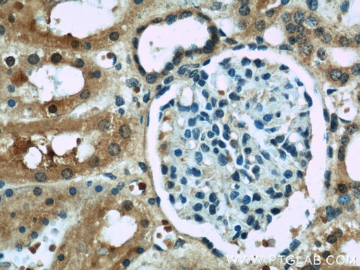[22936-1-AP-20UL] ACOT6 Polyclonal antibody
