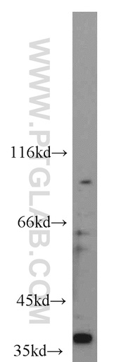 [22943-1-AP-150UL] CDX4 Polyclonal antibody
