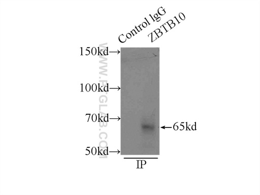 [22944-1-AP-150UL] ZBTB10 Polyclonal antibody