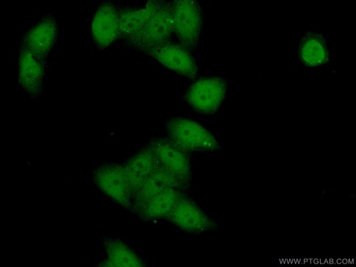 [22947-1-AP-20UL] BCL9 Polyclonal antibody