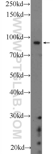 [22964-1-AP-150UL] BARD1 Polyclonal antibody