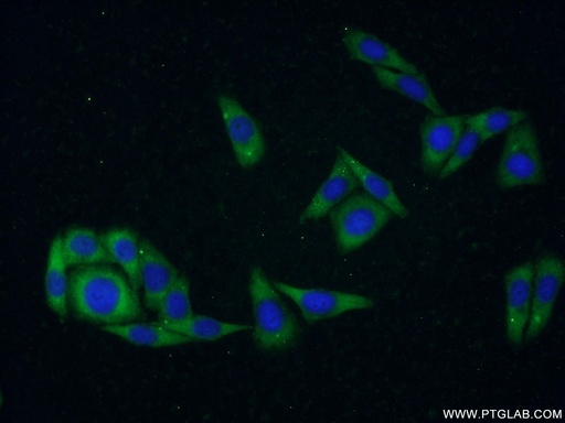 [22988-1-AP-150UL] CDKAL1 Polyclonal antibody