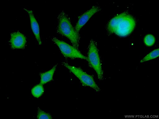 [22989-1-AP-20UL] MMP12 Polyclonal antibody