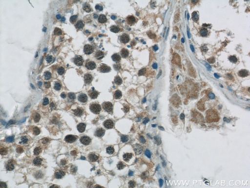 [23001-1-AP-150UL] GBP6 Polyclonal antibody