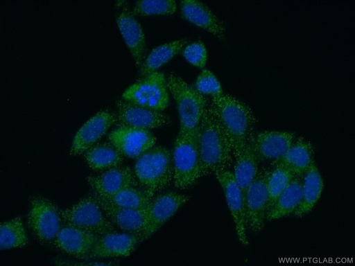 [23006-1-AP-20UL] SCP2 Polyclonal antibody