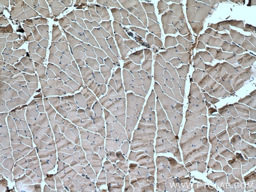 [23016-1-AP-150UL] Nav1.5 Polyclonal antibody