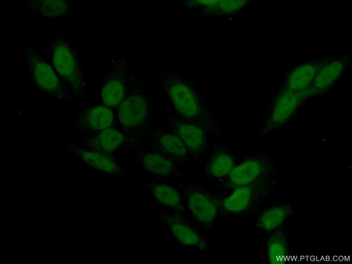 [23024-1-AP-150UL] SCP3 Polyclonal antibody