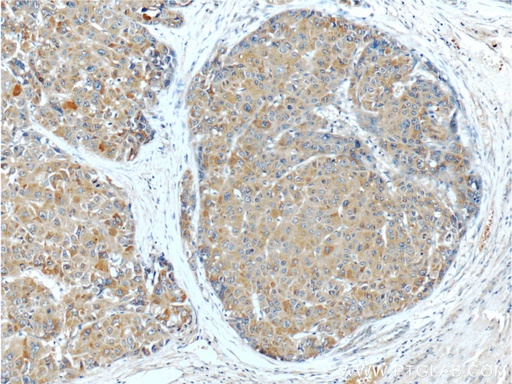 [23029-1-AP-150UL] PGLYRP2 Polyclonal antibody