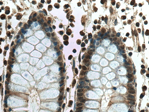 [23030-1-AP-150UL] THAP11 Polyclonal antibody