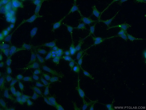 [23042-1-AP-20UL] AKD1 Polyclonal antibody