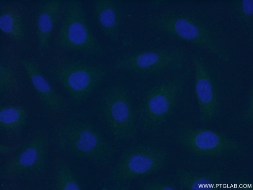 [23058-1-AP-20UL] F7 Polyclonal antibody