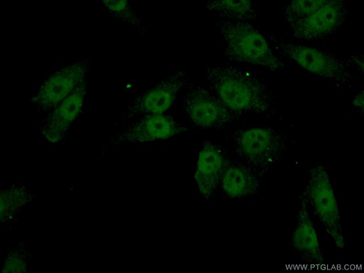 [23066-1-AP-20UL] FOXC2 Polyclonal antibody