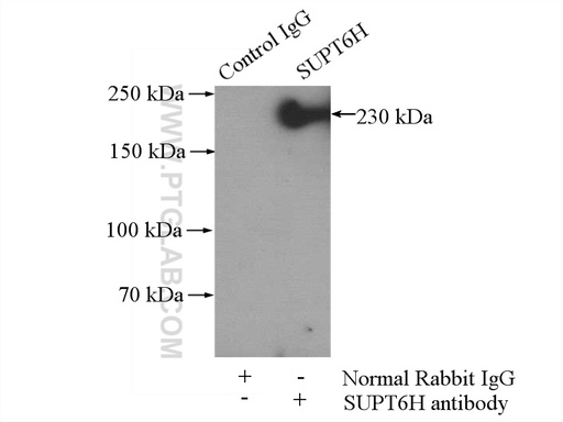 [23073-1-AP-150UL] SUPT6H Polyclonal antibody