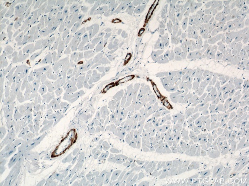 [23081-1-AP-20UL] smooth muscle actin Polyclonal antibody