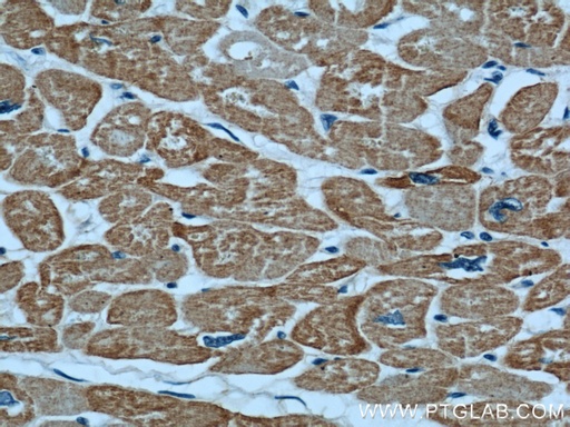 [23082-1-AP-20UL] Alpha Actin Polyclonal antibody