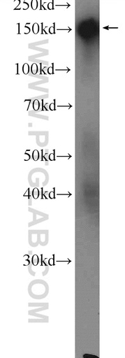 [23087-1-AP-150UL] DSG4 Polyclonal antibody