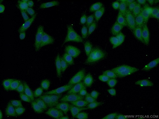 [23108-1-AP-20UL] XRN1 Polyclonal antibody