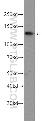 [23114-1-AP-150UL] SALL2 Polyclonal antibody