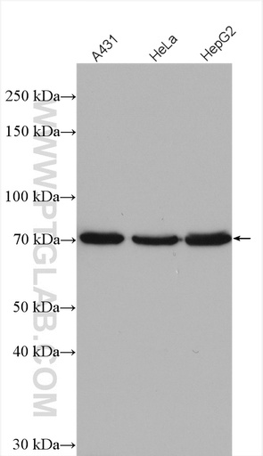[23117-1-AP-150UL] ESRP2 Polyclonal antibody
