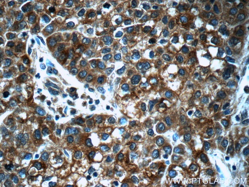 [23125-1-AP-20UL] SCT Polyclonal antibody
